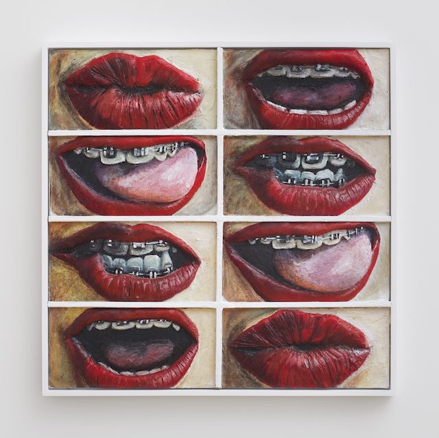 gina-beavers--exibition-at-moma-of-new-york-Who_Has_Braces-2000x1996.jpg