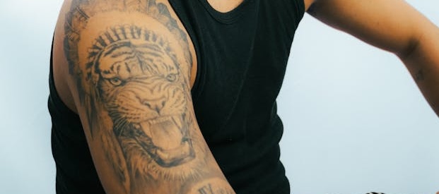 The Mistakes That Make Tattoo Removal Take Twice as Long